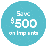 on Implants