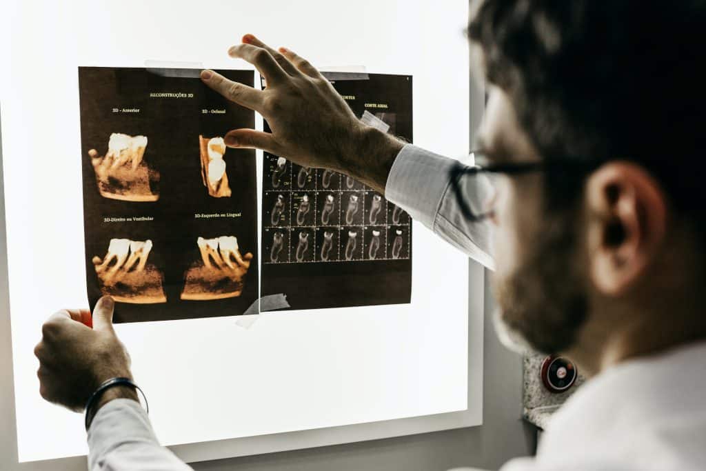 Dentist looking at x-rays