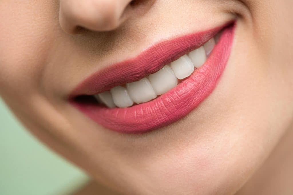 teeth whitening smile