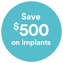 Dental implants offer Ellipse 500 save on implants