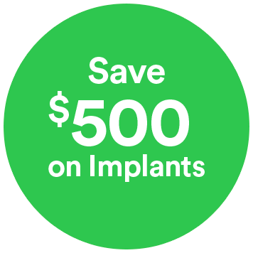 Dental implants offer save 500 onimplants green